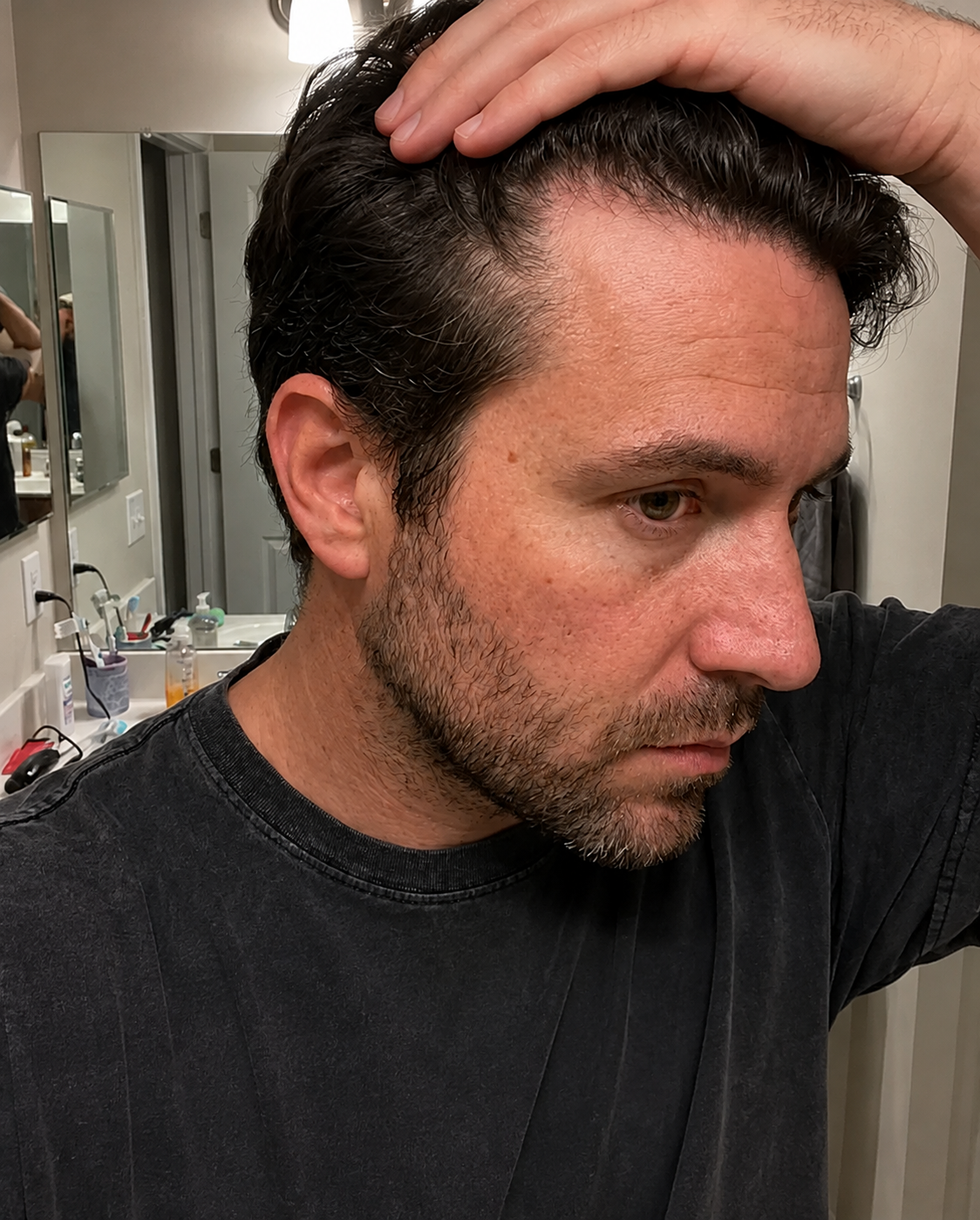 Man inspecting a receding hairline in the bathroom